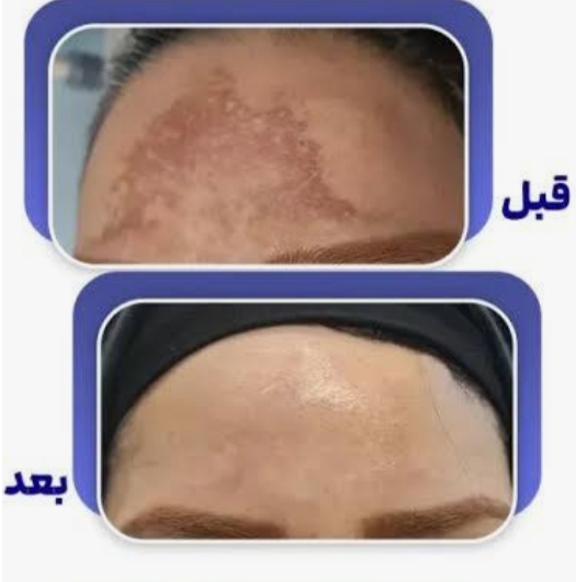 کرم معجزه اصل(mojezeh)